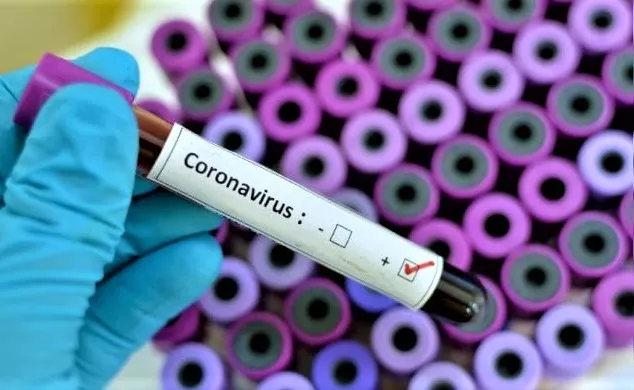 Coronavirus, in Italia è corsa al vaccino, ma Russia e Cina hanno le cure. L’elenco dei 30 farmaci | Rec News dir. Zaira Bartucca