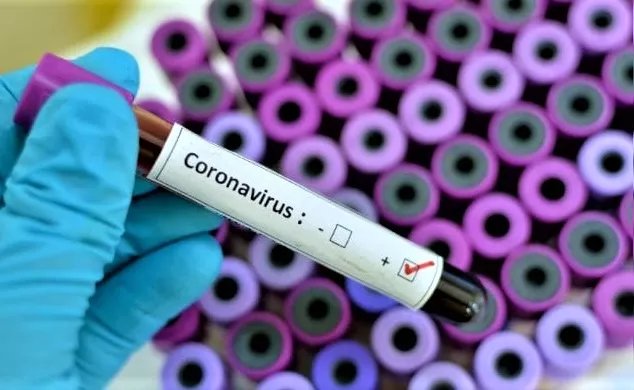 Coronavirus, in Italia è corsa al vaccino, ma Russia e Cina hanno le cure. L'elenco dei 30 farmaci | Rec News dir. Zaira Bartucca