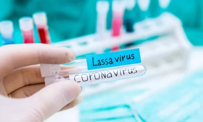 Hanno finito col coronavirus e ora iniziano con la febbre di Lassa | Rec News dir. Zaira Bartucca